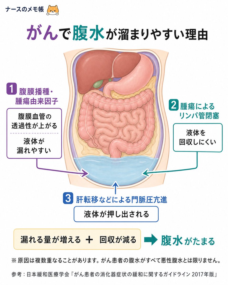 nurse84memo's tweet photo. 病態生理シリーズ

癌で腹水が溜まりやすい理由 https://t.co/6WG1yoFcik