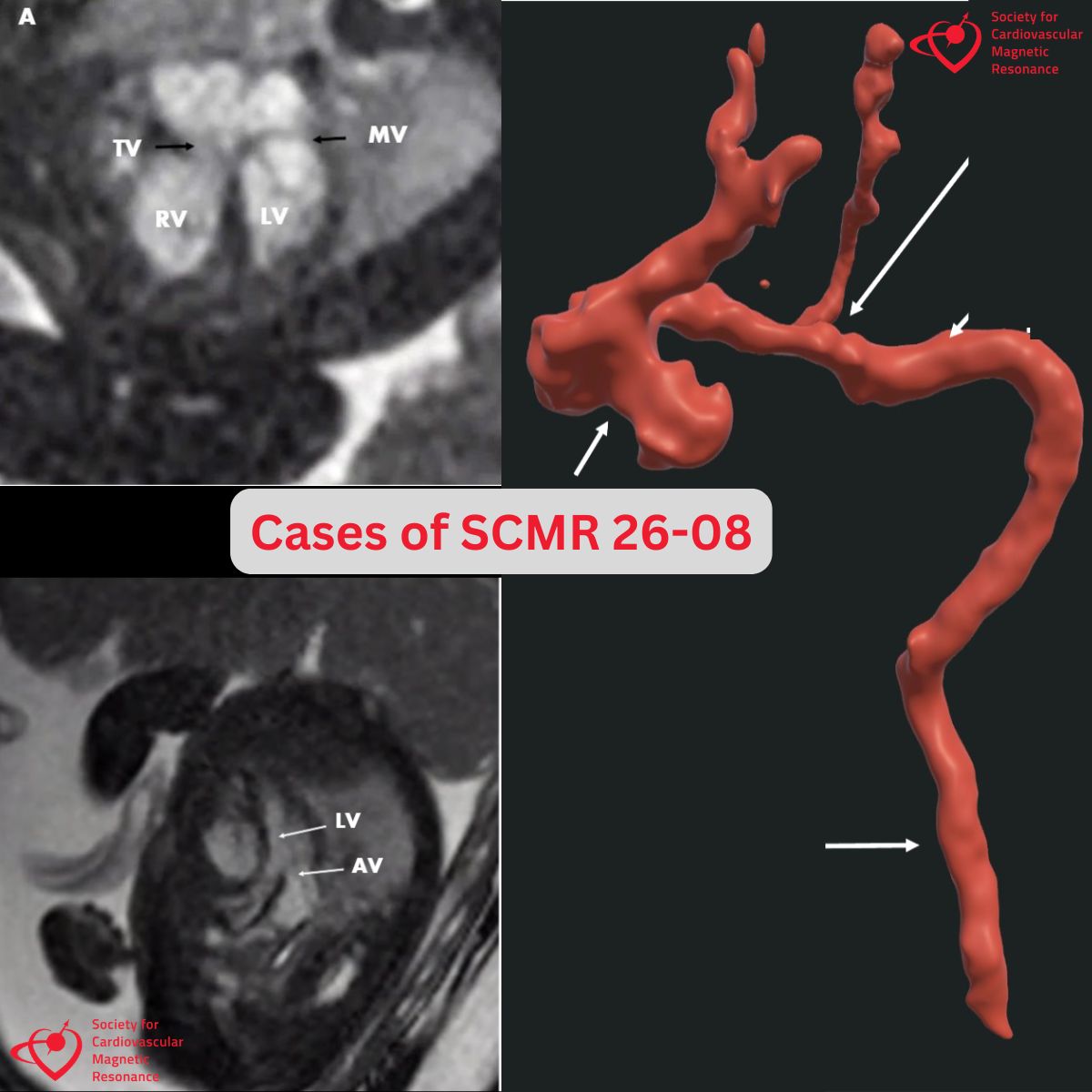 Society for Cardiovascular Magnetic Resonance tweet media