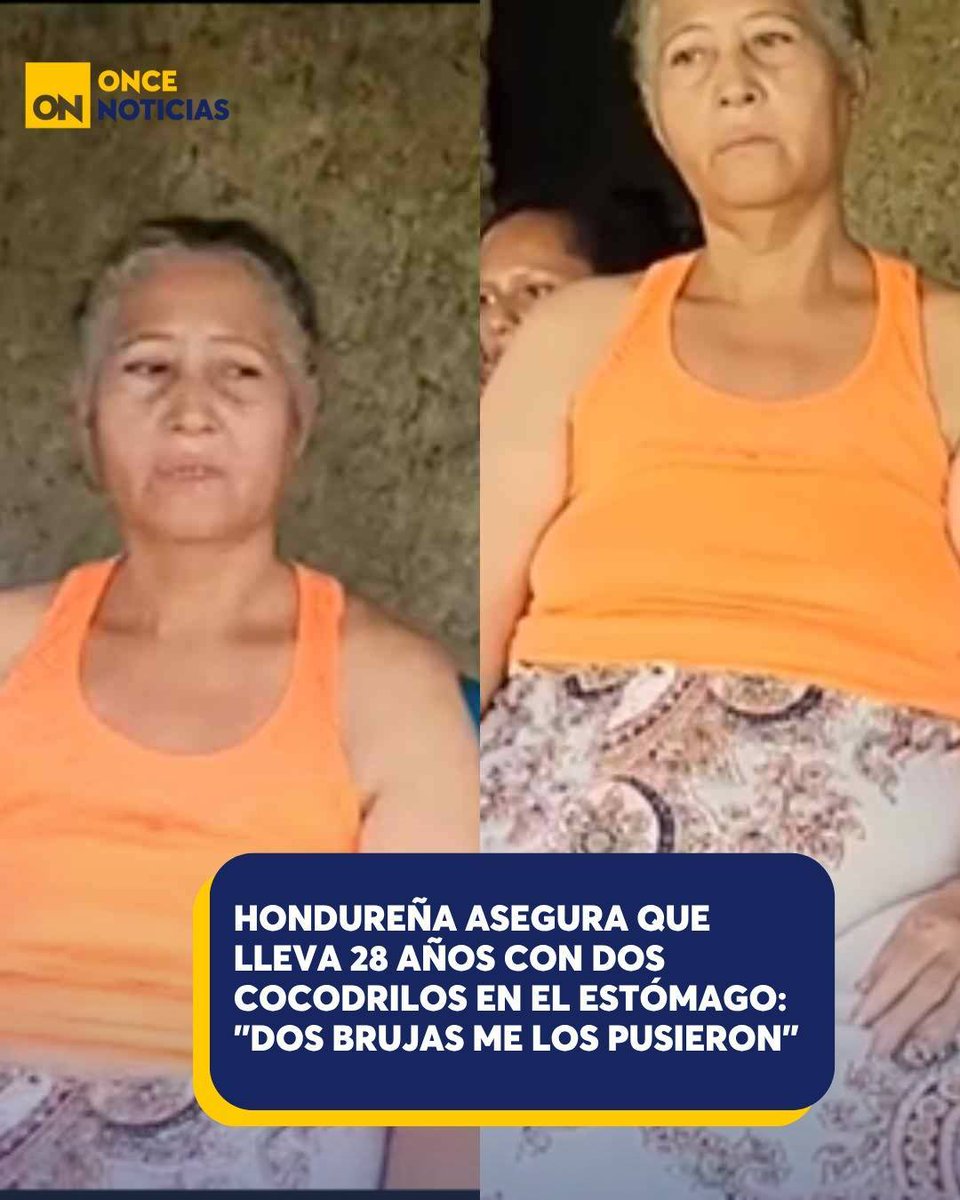 11_Noticias's tweet photo. 😳 "Me hablan y quieren salir", afirma la hondureña. Su testimonio ha provocado todo tipo de reacciones en redes sociales y ahora su familia busca apoyo.
Aquí el video: https://t.co/3xzoyvvLFX
#Hondureña #Estomago #Cocodrilos https://t.co/NiIhSh9rTp
