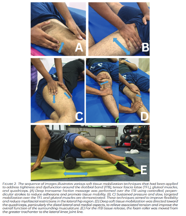 PhysioMeScience's tweet photo. Effectiveness of Manual Therapy Versus  Strength Training for Iliotibial Band Syndrome on Pain and Functional  Recovery in Runners: A Pilot Study

https://t.co/AdEN3E2IWQ https://t.co/53eySdhTW9