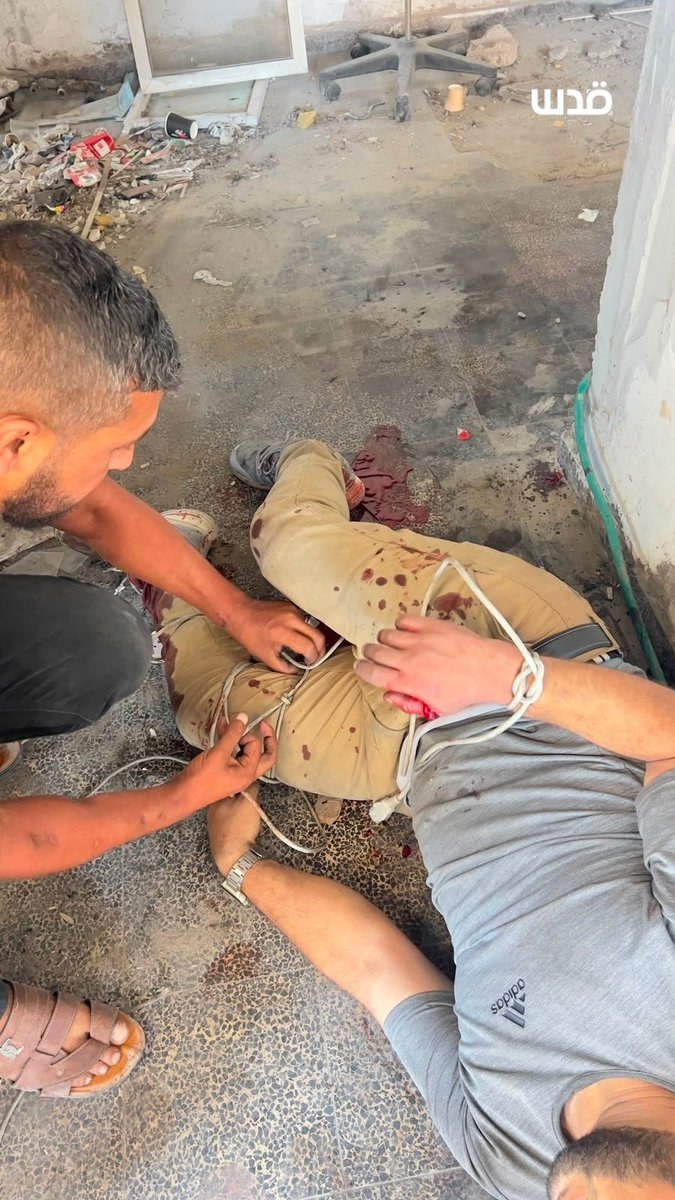 dn_osama_rabee's tweet photo. Three security staff members at Kamal Adwan Hospital in northern Gaza were injured after an Israeli drone targeted them while they were having lunch. https://t.co/OChHulQWb4