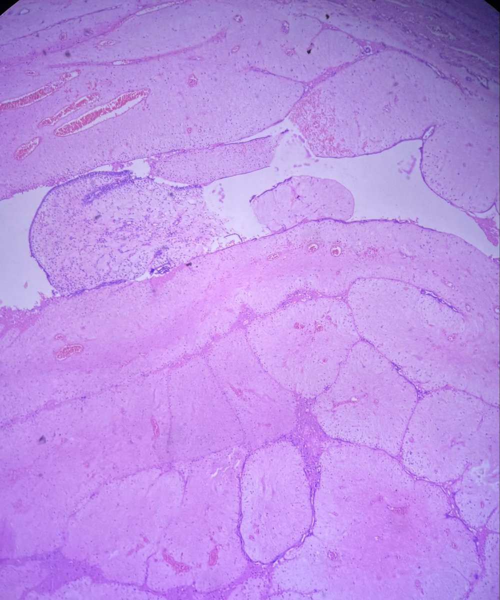 swatisetiya16's tweet photo. 30 year old, breast lump. https://t.co/rPMHbyCmOU
