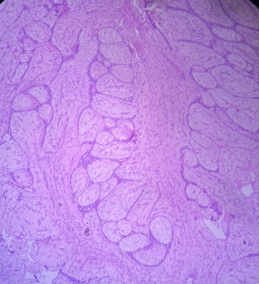 swatisetiya16's tweet photo. 30 year old, breast lump. https://t.co/rPMHbyCmOU