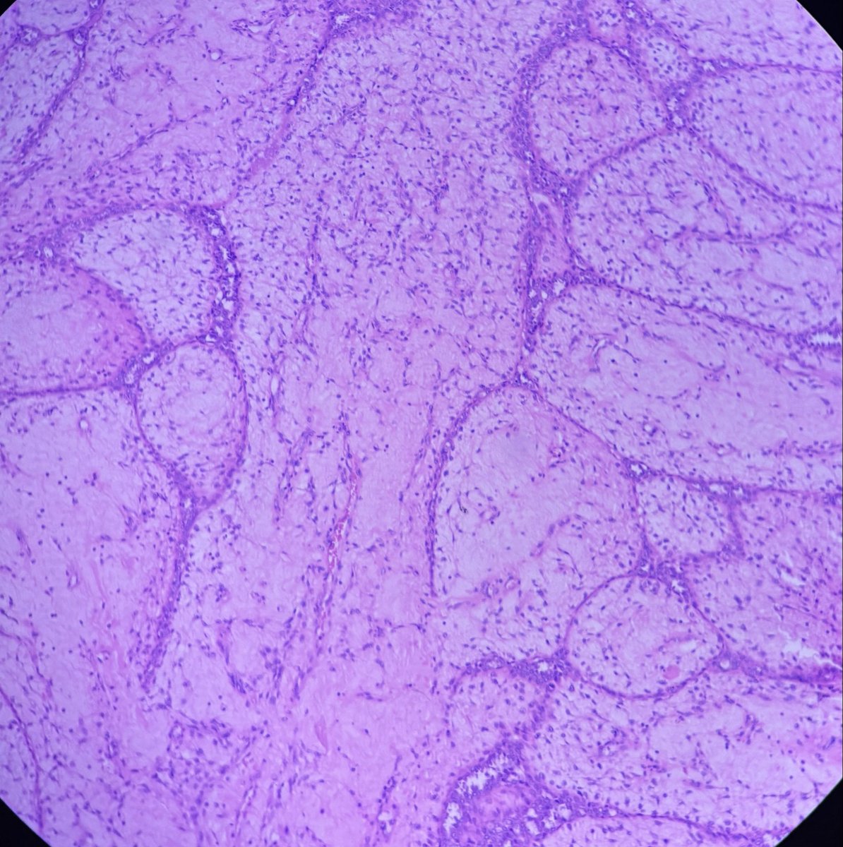 swatisetiya16's tweet photo. 30 year old, breast lump. https://t.co/rPMHbyCmOU