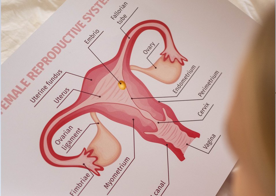 MesenchymalCell's tweet photo. Through multiple #transcriptome analyses, researchers found that LGR5 plays a crucial role in the decidualization of #endometrial mesenchymal stem cells (ESCs). https://t.co/kKJGj9AZgV
Their work shows that LGR5 may contribute to the therapeutic efficacy of decidualization ESCs for thin endometrium repair, potentially through regulation of PGR via the β-catenin pathway.