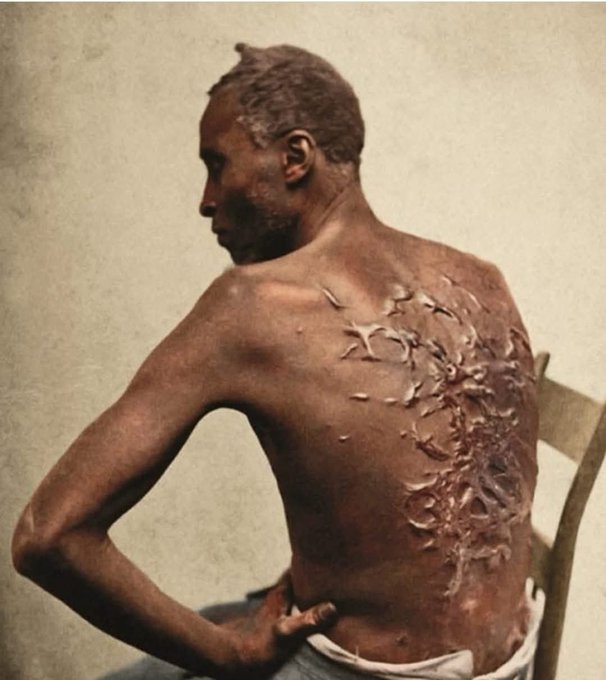 Elizabeth_Ruler's tweet photo. Escaped enslaved man, Gordon, also known as 'Whipped Peter,' shows the scars on his back in Louisiana, 1863. The Trump administration ordered the removal of this photo, along with other signs and exhibits related to slavery, from several national parks. https://t.co/jSHplzye46