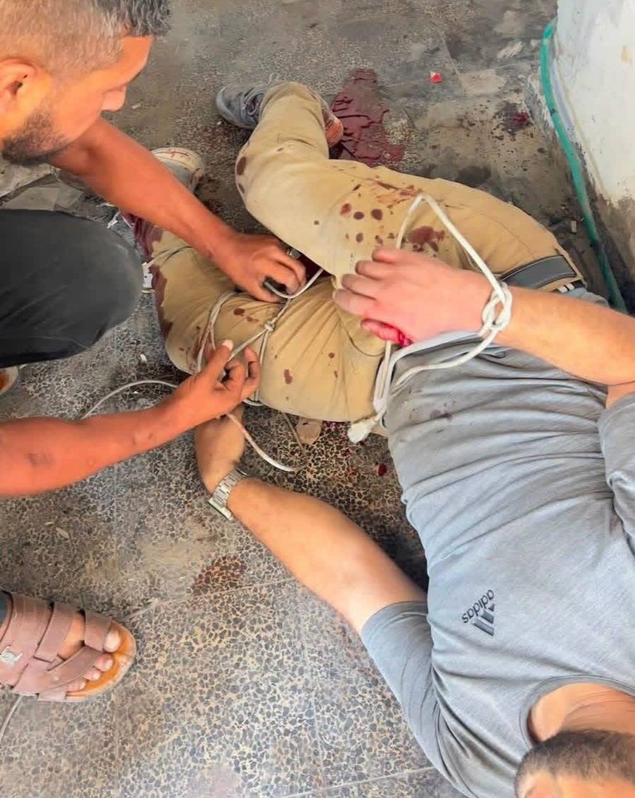 nowgnna's tweet photo. أثناء تناولهم وجبة الغداء.. إصابة 3 عاملين في قسم الحراسات بقصف استهدف مستشفى "كمال عدوان" شمال غزة.. https://t.co/HW2ZASPtME