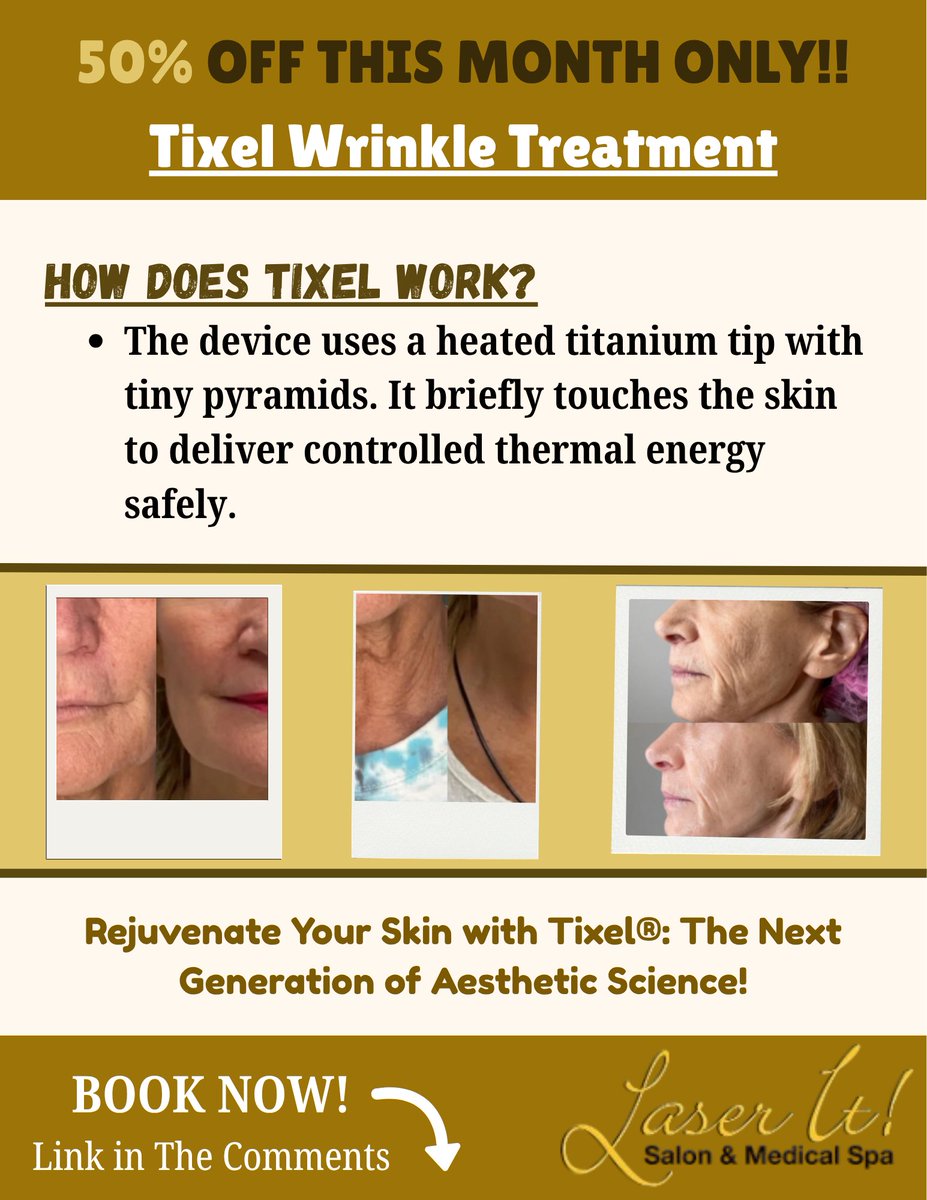 laseritspa's tweet photo. Experience the benefits of Tixel® Enjoy minimal downtime, a virtually painless treatment, safe results for all skin types, and visible skin improvement after just one session.
Even delicate areas, including the lash line, can be treated.
#Windsorontario #Tixel #SkinRejuvenation https://t.co/lBqcmZWoAq