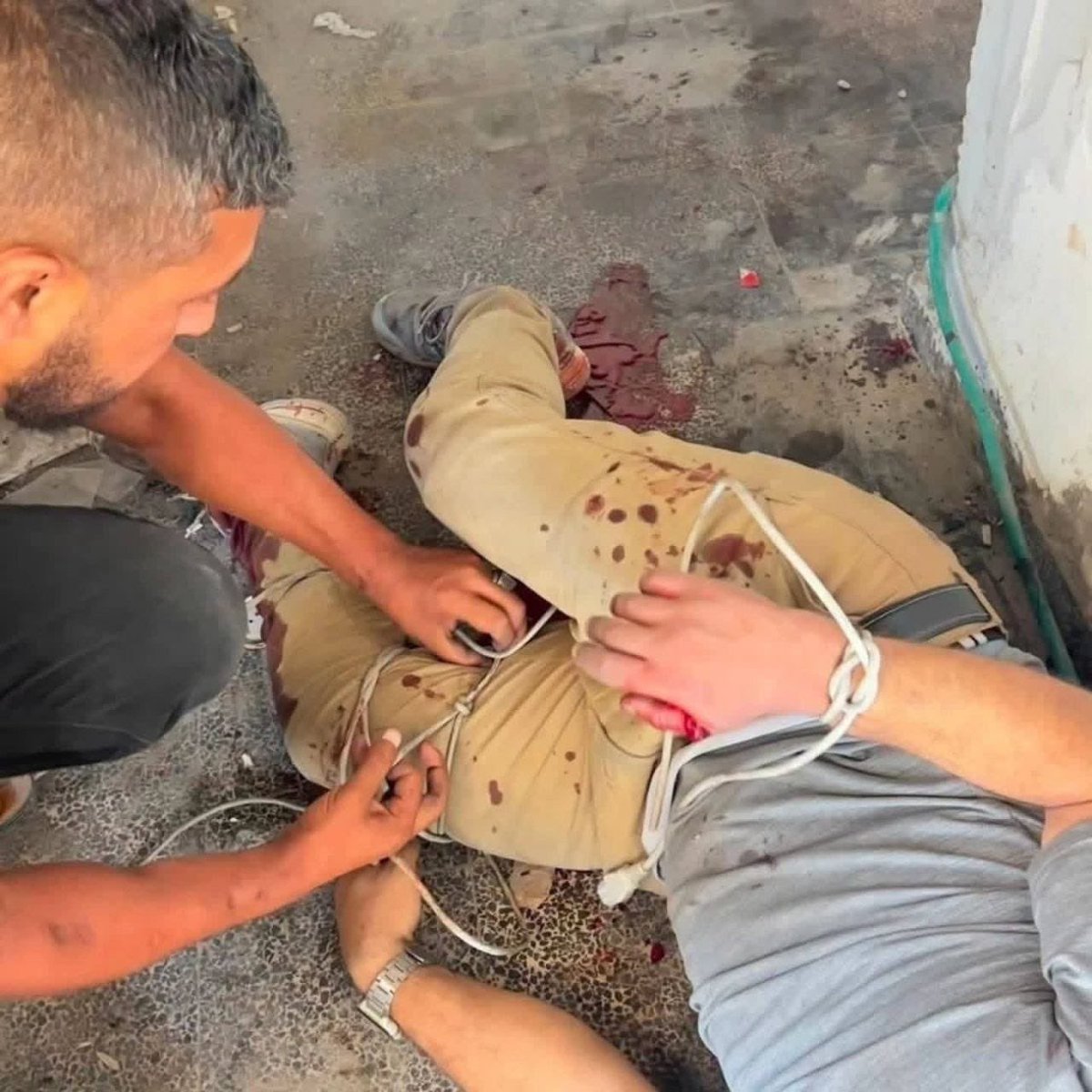 DropSiteNews's tweet photo. 💢Two maintenance workers were injured after an Israeli quadcopter attacked Kamal Adwan Hospital in northern Gaza this afternoon while they were having lunch, according to Healthcare Workers Watch Gaza. https://t.co/9ViWgy9BF5