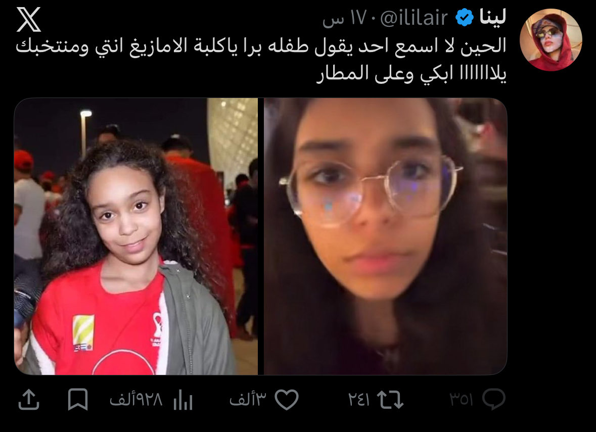 kndrr11's tweet photo. من زمان ودي اقولكم شيء،

البنات متنمرات اكثر من العيال لأن ماعندهم حدود بما في ذلك الأعمار، على مدار عقود خُدعنا بأنهم الجنس اللطيف، اتمنى نبدأ نستوعب حقيقة الأمر https://t.co/D68InqZkNl