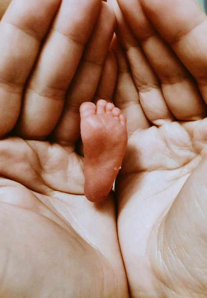 Silvianeonatos's tweet photo. 🎯 NUEVO CURSO de @EuiSantPau:
🔸️Cuidados Centrados en el Desarrollo Neonatal y la Familia: El Recién Nacido Prematuro de Alto Riesgo.
✅️ Una semana de clase con los mejores profesionales de Sant Joan de Déu y Sant Pau.
✅️ Una semana de prácticas en UCIN de @HospitalSantPau https://t.co/0Jye2Ck8sX