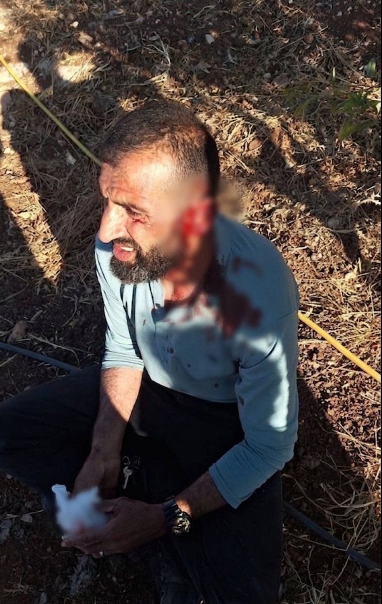 QudsNen's tweet photo. Extremist Israeli settlers attack a Palestinian in the town of Beit Furik, occupied West Bank, injuring him in the head. https://t.co/Xjj7F3dUBQ
