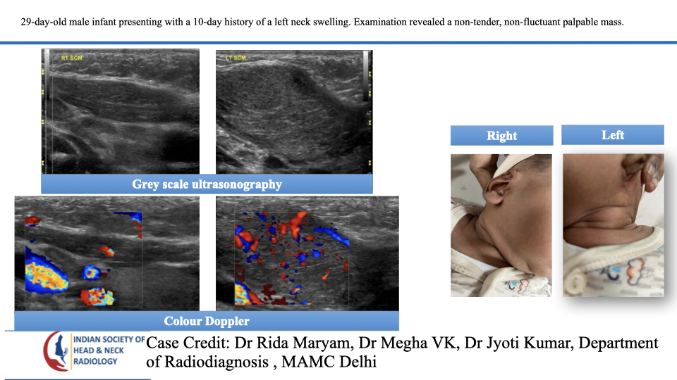 teamishnr's tweet photo. #caseoftheweek
What are the findings and DDx?
The answer will be uploaded tomorrow
#radiology #caseoftheweek #headandneck #radiologycases #dailywork #ISHNR #teaching #research #imaging #FOAM #FOAMRad #FOAMed
Visit our website: https://t.co/9KlZmntJ98 https://t.co/wje0hbPlum