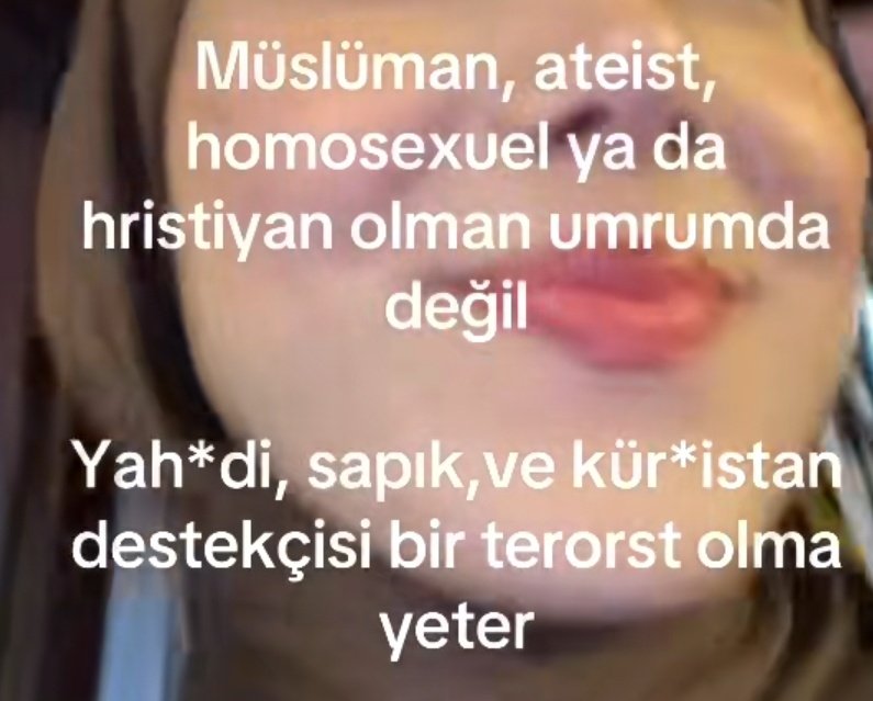 waterde🇹🇷 tweet media