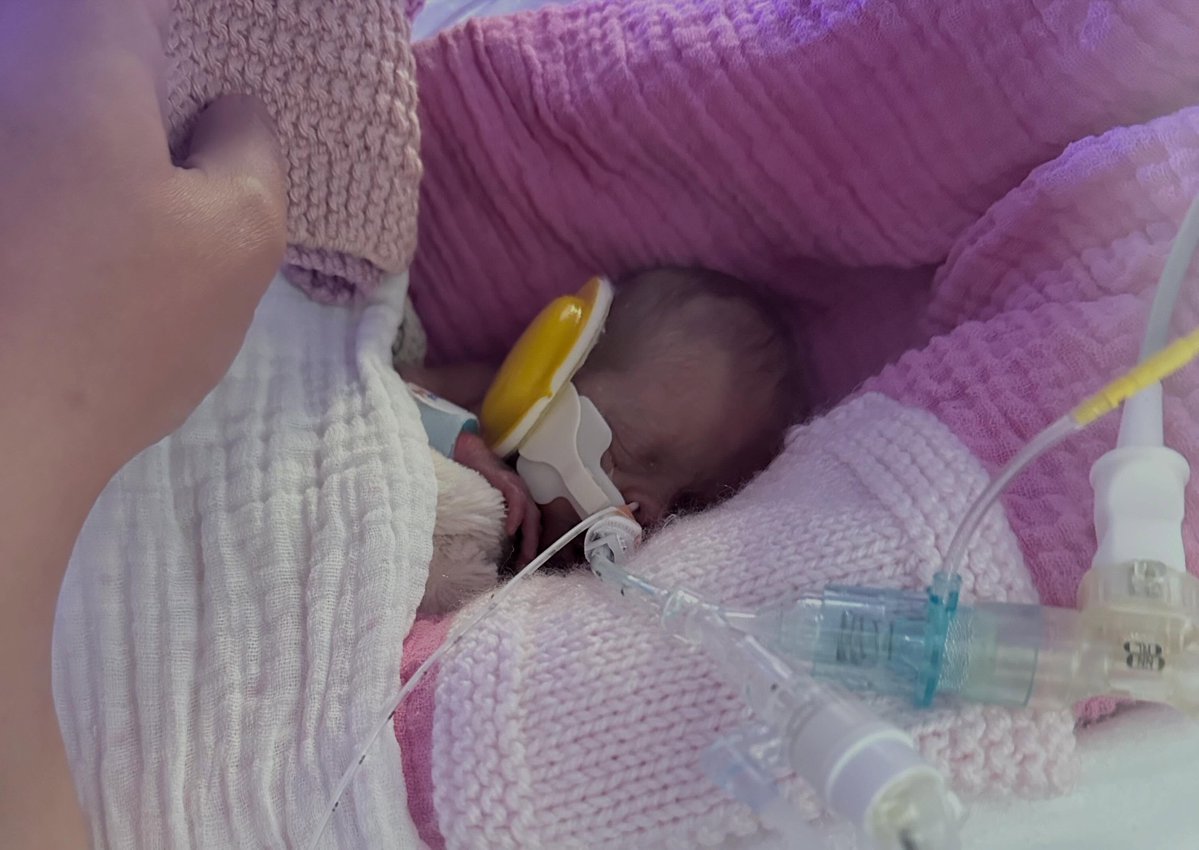 LiveAction's tweet photo. Pray for paralympian Jessica-Jane Applegate’s baby girl, Alara.

Alara was born premature at 23 weeks, 2 days.

She is currently in the NICU and fighting a chest infection.

Thankfully, doctors are working hard to help her heal and grow.

Every child is worth fighting for. https://t.co/BzJHBPHE5k