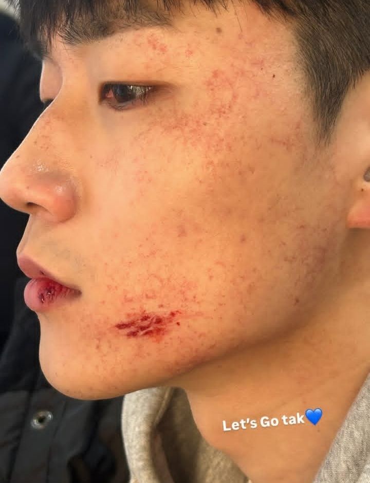 Junjaelee_'s tweet photo. I just know Seongje has this photo in his favorites
#seongtak https://t.co/STOXaHt9HH