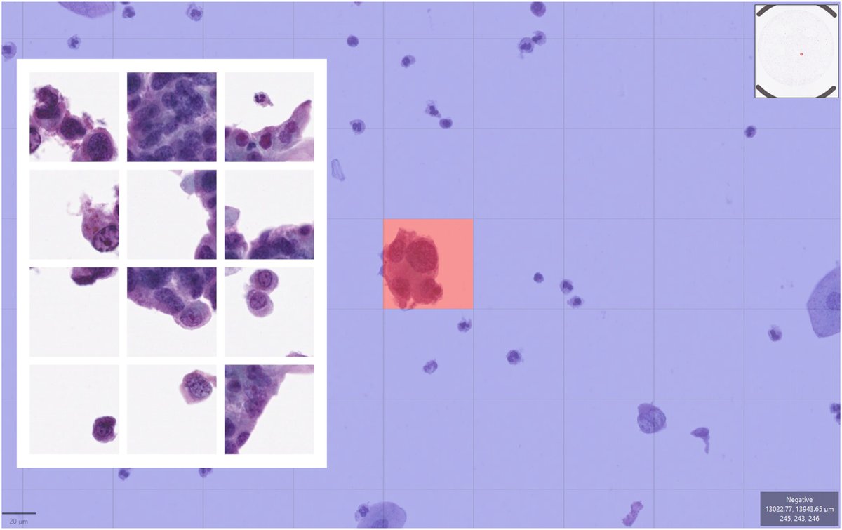 CancerCytopath's tweet photo. #OpenAccess | The role of #cytopathology in the molecular and computational era: The perspective of young #pathologists. New avenues for collaboration, education, and remote consultation are opening.

https://t.co/qlAb0KmiLV

#CytoPath @ACaputoMD @VLimperioMD @PasqualePisapia https://t.co/JLqWSHSIrU