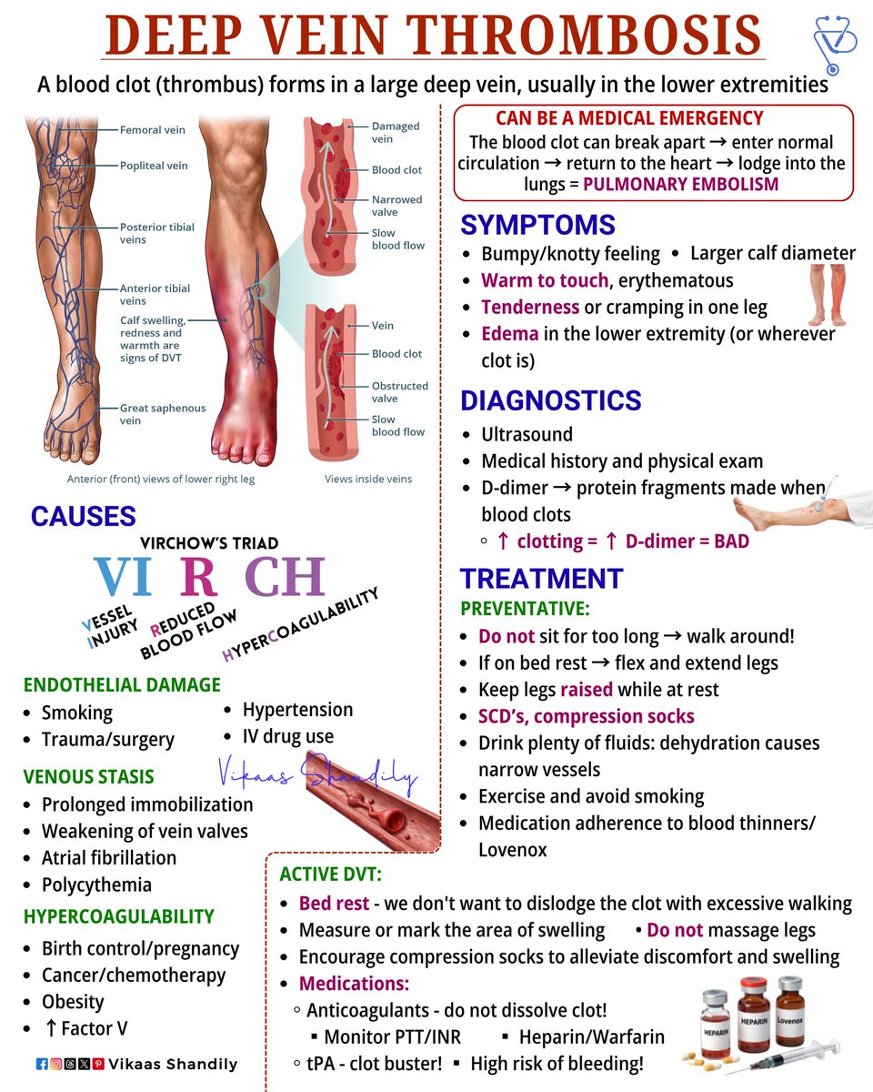 VikaasShandily's tweet photo. Deep Vein Thrombosis (DVT): The Silent Blood Clot You Should Never Ignore 
#DeepVeinThrombosis #BloodClot #VascularHealth #medical #VikaasShandily https://t.co/QB8PY0R96y
