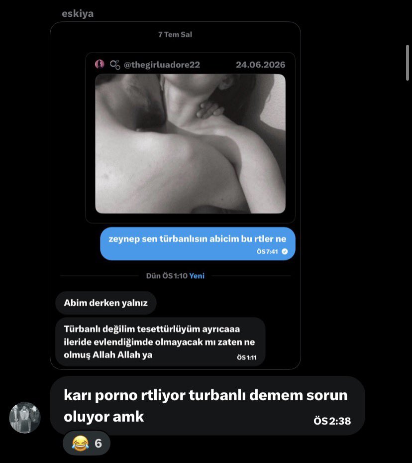 eceetektas's tweet photo. gulmekten bayilicam simdi https://t.co/yVXpteTd4r
