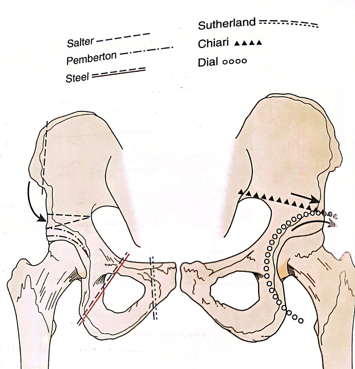 YTraumatologia's tweet photo. https://t.co/KJWygrqyou