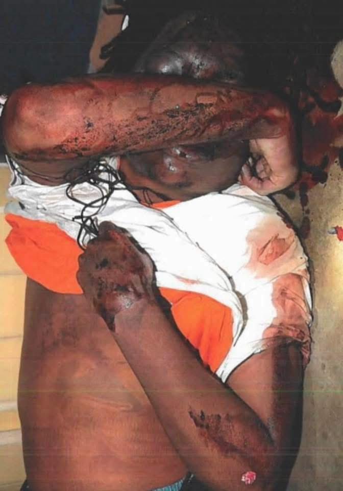 nubian6's tweet photo. Did y’all know the case of Kendrick Johnson never got solved. 13 years ago, he fought a white classmate, and the father of the white boy was extremely mad because he lost the fight,  and asked Kendrick to come over and fight him again. Kendrick refused. Soon after, Kendrick walked into the gym room of his school, and was attacked. They claim he fell into a gym mat and wasn’t able to free himself. And all the damage you see done in these pictures below, he done it to himself. The family wasn’t informed he was deceased till the next morning. And his body was took unauthorized, split open, organs took from his body, which is nowhere to be found till this day. They stuffed his body with newspaper like he was a garbage can, and closed him back up. The family had no idea until they had him checked again for their own investigation. They even went as far to cut his whole back open for no reason at all. He was tased, beat, choked and I’m sure manhandled by more than 2 people. Now I don’t know if y’all woke or not, but this can happen any day to any of our children. Why aren’t we talking and making a big fuss about this? His death is just as serious as Emmit Till. His family is still grieving. Still have no answers but haven’t given up the fight. 

GOD I know you’re a work of wonders. Please get this case back into the light of all African Americans so they can see, this can and will be done to you, or anyone in your family any day at any time. I want these pictures shared all over the world. Let’s get this case back open and show this young man who’s no longer with us we’ll NEVER FORGET. If you care even a little it means ALOT. PLEASE PLEASE share this post so that everyone could see what being black can get you in AMERIKKKA. #JusticeForKendrickJohnson #sayhisname  ✨