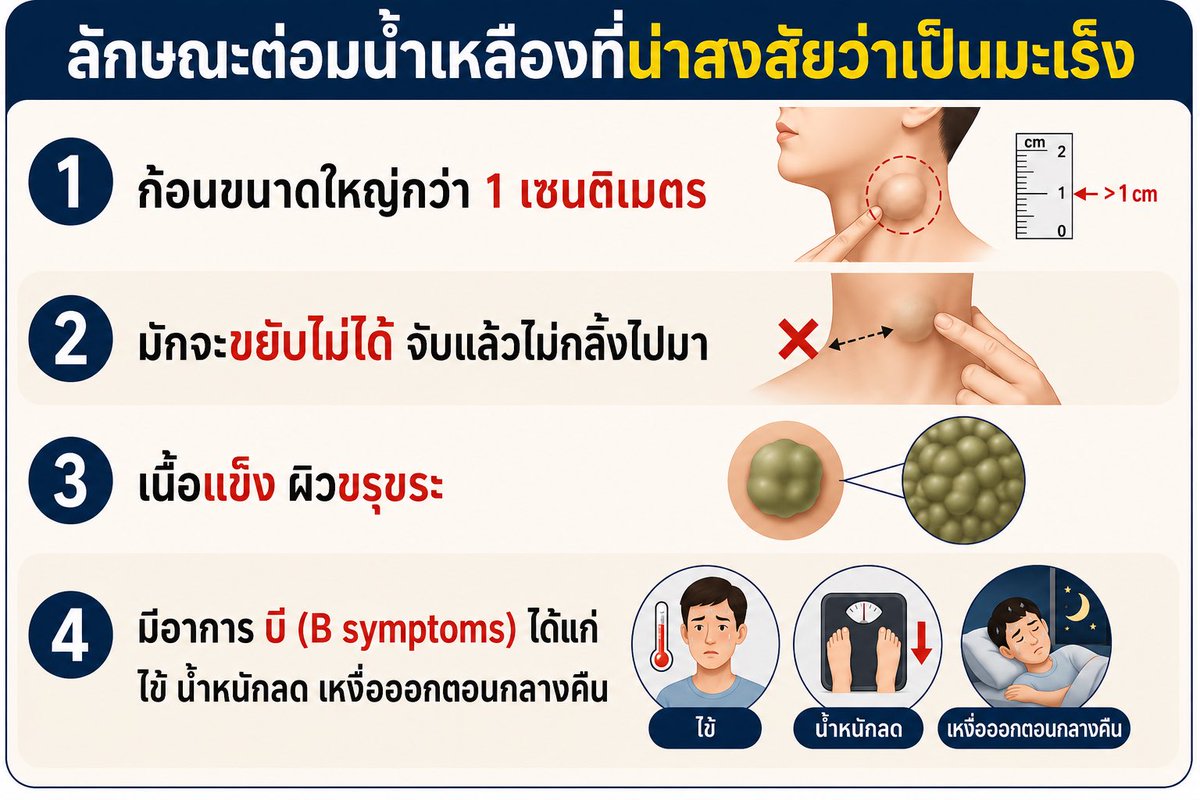 pasitnat's tweet photo. คลำเจอก้อน ไม่รู้ว่าเป็นต่อมน้ำเหลืองหรือมะเร็งไหม ต้องรู้ตำแหน่งต่อมน้ำเหลืองก่อน 

แล้วค่อยดูว่ามันมีลักษณธคลอายมะเร็งไหม ไม่ว่าจะเป็นมะเร็งต่อมน้ำเหลือเองหรือมะเร็งที่แพร่กระจายมายังต่อมน้ำเหลือง

รูปแรกจาก ChatGPT
รูปสองจาก Thai cancer society https://t.co/JFhBoGRj7O