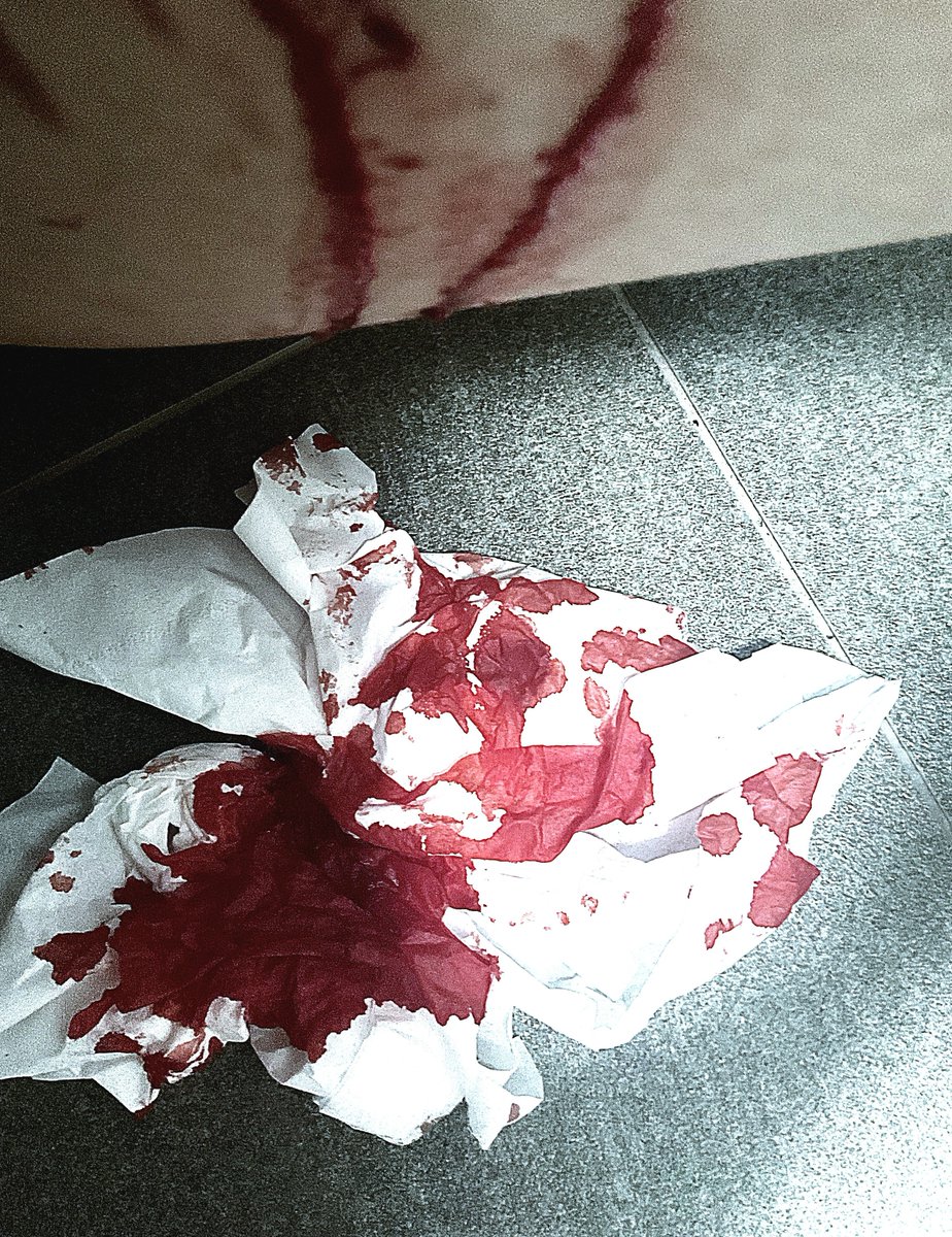 cherepa_ranu's tweet photo. dude my paint spilled on the floor(  shitwt what do you even call s h twt nowadays? https://t.co/lIbVDnyJq3