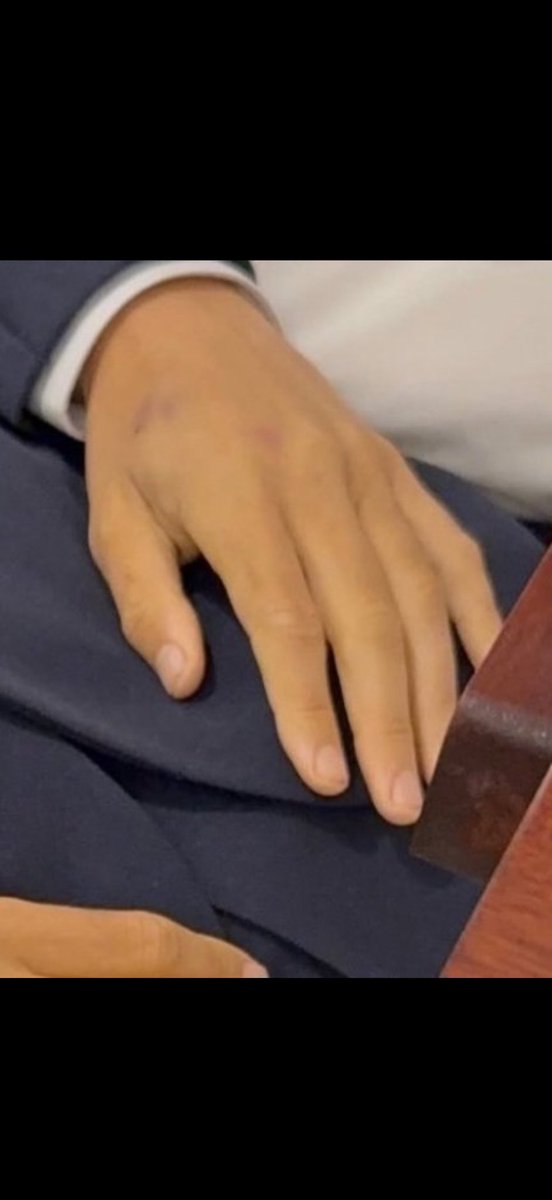 realjakebush's tweet photo. @AgentStarSlayer @RealCandaceO Blood spatter doesn’t leave a bruise, Bud https://t.co/8RY7cGPj04