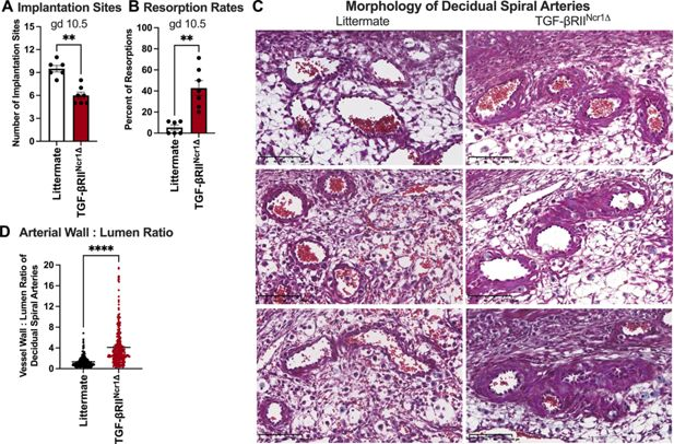 LabWaggoner's tweet photo. TGF-β drives the conversion of conventional NK cells into uterine tissue-resident NK cells to support murine pregnancy @eLife @WashU 
https://t.co/4IJWWla8HT https://t.co/z3M2Kls1Ll