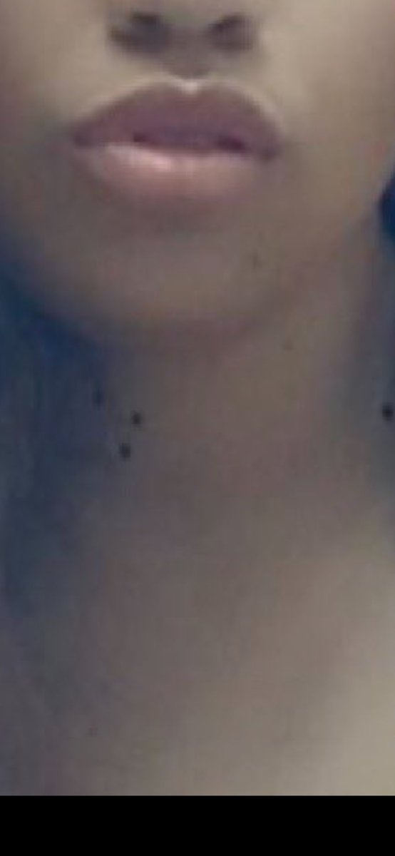 Mikefit93's tweet photo. @CharityBallew @plies Fuck is on your neck?!?!?! No way you thought these pictures were a flex 🤮🤮🤮🤮🤮🤮🤮🤮🤮🤮🤮🤮🤮🤮 https://t.co/vFtd6Qkp7Z