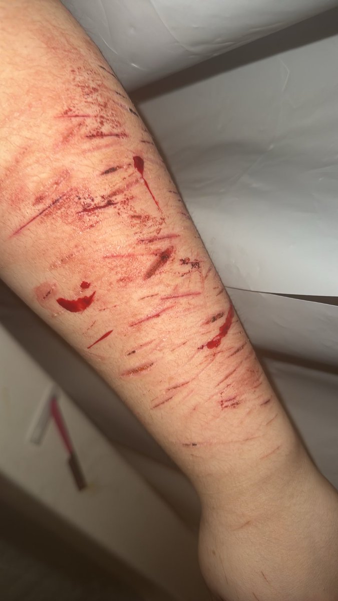 fuckfaceash's tweet photo. @ao3chann ai sfx makeup 🤔🤔they’re not as sharp as i thought they’ d be but unmmmm i might try to hit beans tnite anyways here’s some ittle styros https://t.co/dJXFMHANw0