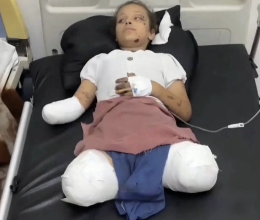 zvonko2026's tweet photo. ISRAËL A FAIT CELA.

Voici Razan, une fille de 13 ans de Gaza. https://t.co/nJbTeUJO5a