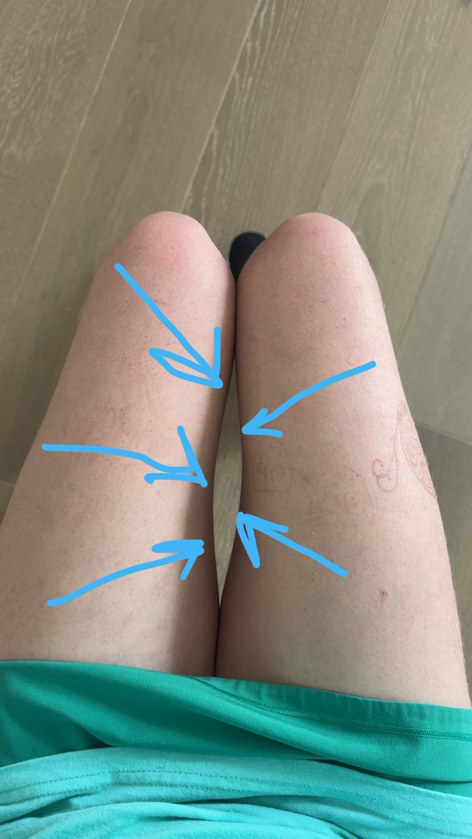 halfway__down's tweet photo. no thigh gap yet but i finally have This Thing #bc https://t.co/l9yTbrA4XU