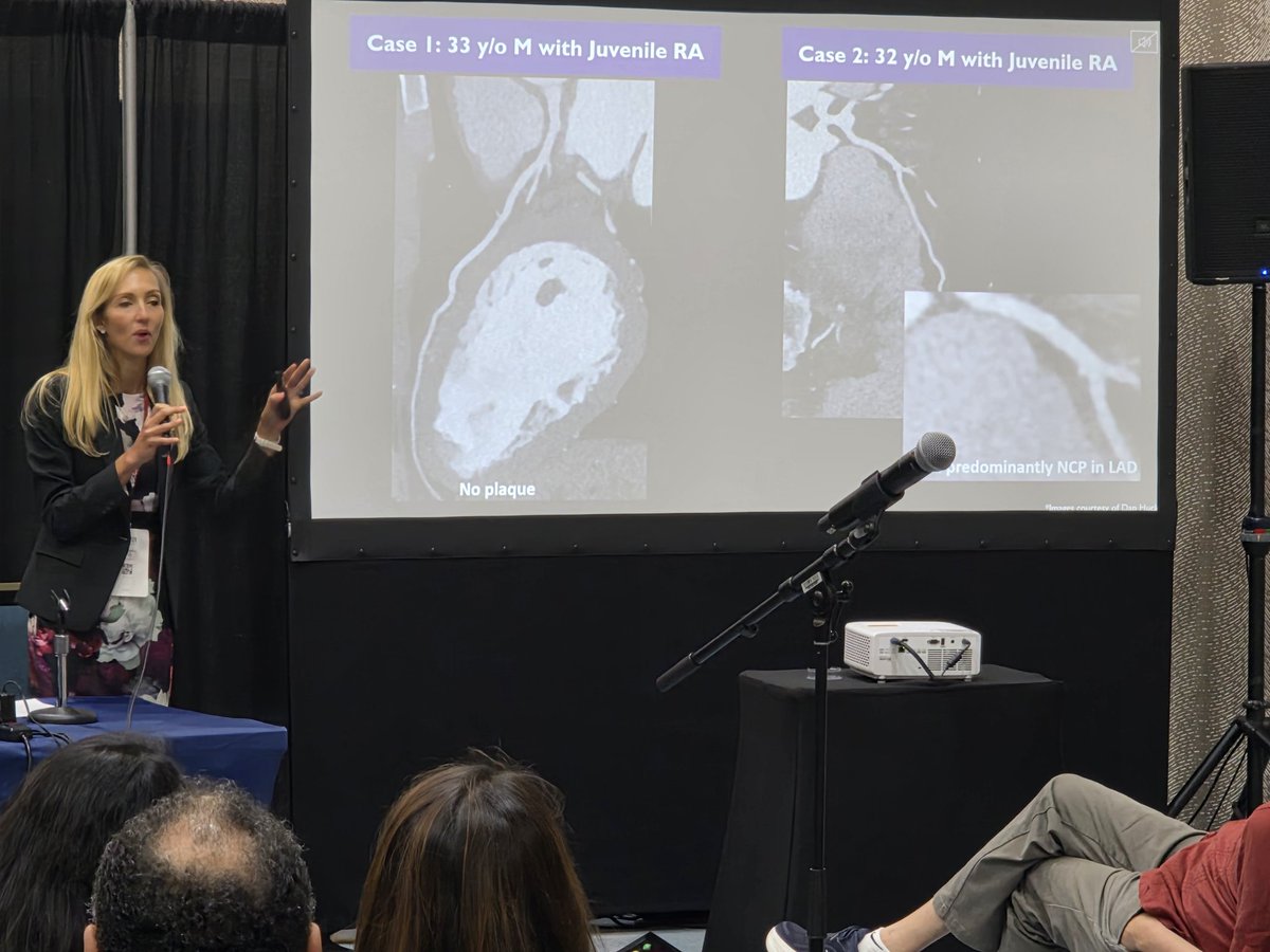jonathan_aun's tweet photo. 🌟From PCAT to FAI @Bweber04 illustrates the value of plaque biology in Immune Mediated Inflammatory Disorders!🔍 Highlighting the potential value of these tools to risk stratify &amp; monitor therapy!🫀 #EarlyCareer  @Heart_SCCT @UTSWMedCenter @BWHCVImaging #SCCT2026 @Heart_SCCT https://t.co/CWOXqmZk2v