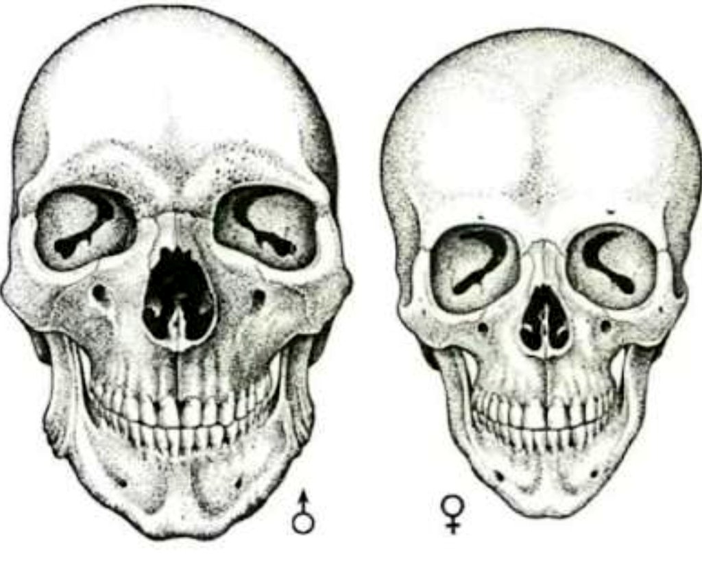 37Lemons's tweet photo. FTM dancer Maksim Chmerkovskiy &amp; MTF figure skater Meryl Davis

NYC 2014

Maksim with the female skull, beady eyes, small face positioned low under the vertical 5head, high ears

Meryl with the male skull, deep-set far apart eyes, sloping back forehead, large face, low ears https://t.co/WXoq516W7u