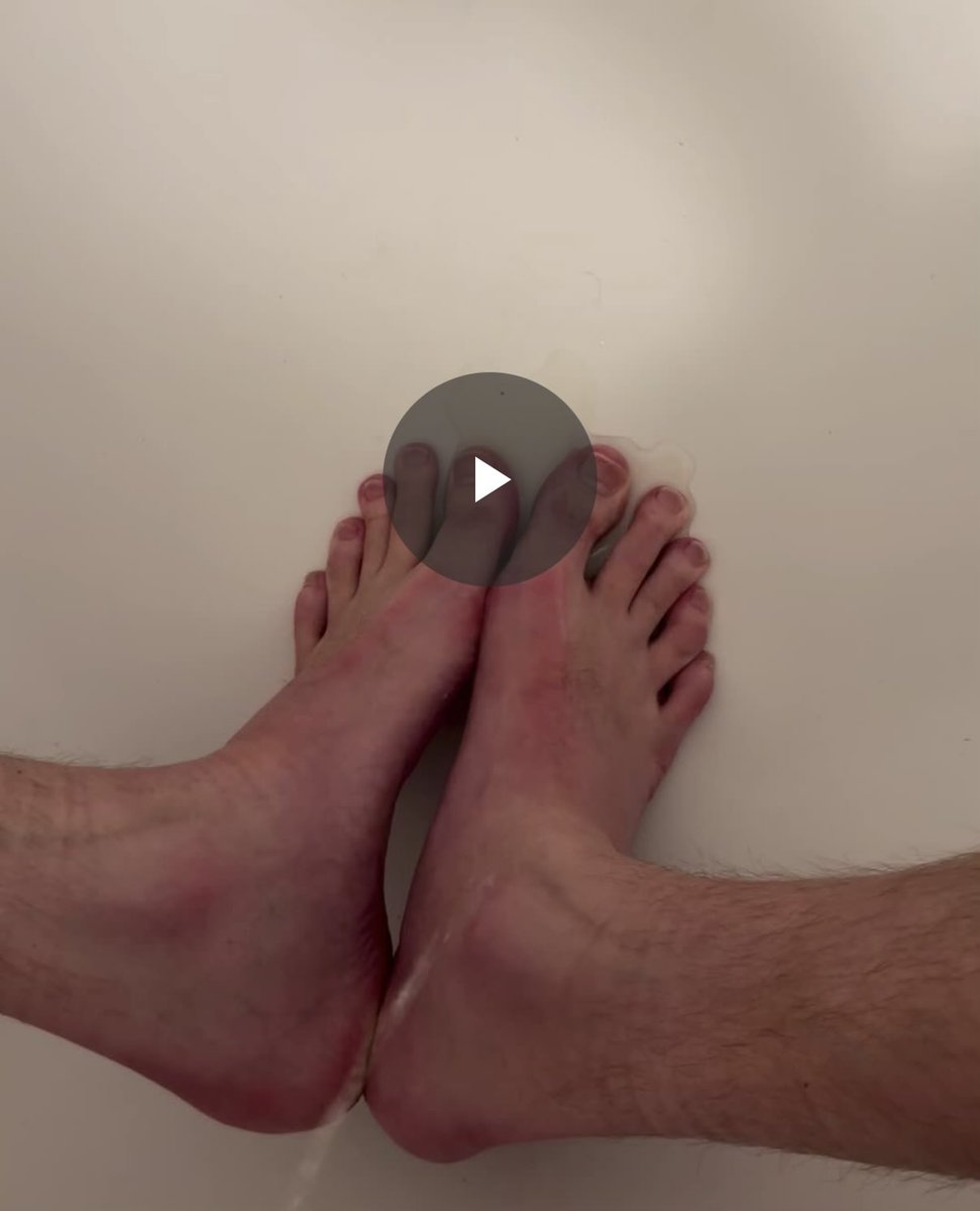 UrDaddysFeet's tweet photo. One for the kinksters.
A #footpig asked me to piss on my feet;
he wants to imagine licking it off my toes.
I'm a nice dom, so I help him out. Needless to say he loved it. 𧦠π¦Άπ»
Want to see the video? Drop me a DM π€
#footdom #footsub #findom #feetpics #feetvideo #worshipme. https://t.co/cRwCVKreoB