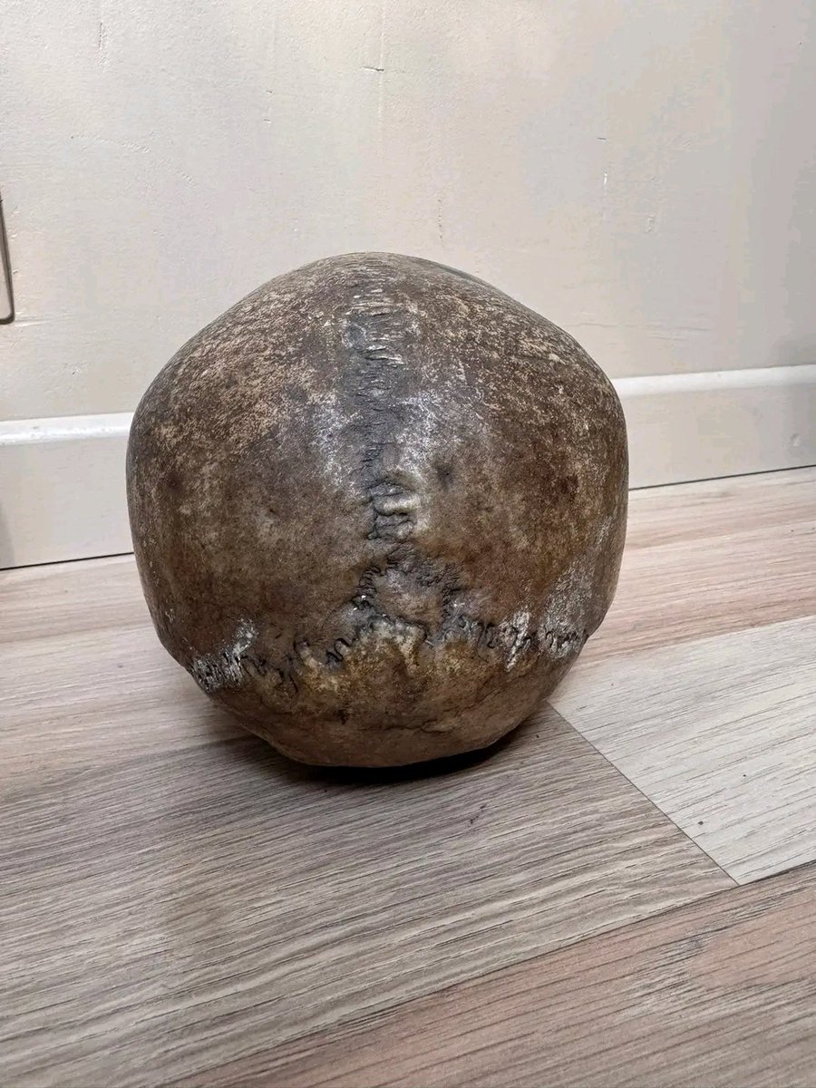 WilliamsJa60455's tweet photo. Human skull geriatric, great patina with no jaw 350€ + shipping 

Geriatric jaw 100€ + shipping

Human skull with jaw 850€ + shipping

Rottweiler skull 180€ + shipping https://t.co/XLZ7Vfux0C