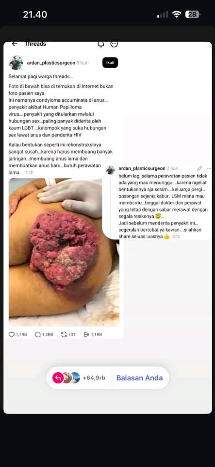 alhasannn1's tweet photo. Penyakit CONDYLOMA ACCUMINATA
Akibat hubungan anal sex https://t.co/IAm0kgMOKt