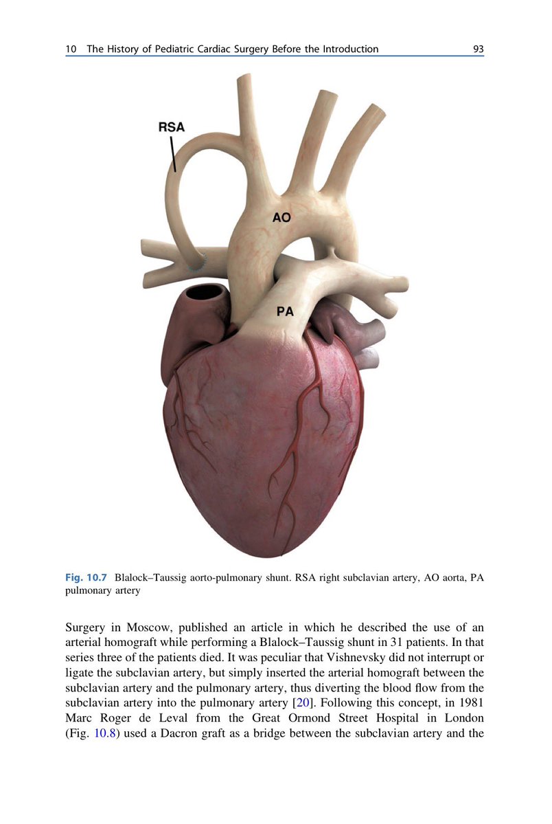 alex1708ander's tweet photo. First learn the procedure. Then image it. ⭐ Understanding 🧠 drives imaging 🖥️ #learnfirst #echofirst https://t.co/xWvcDjz2dC