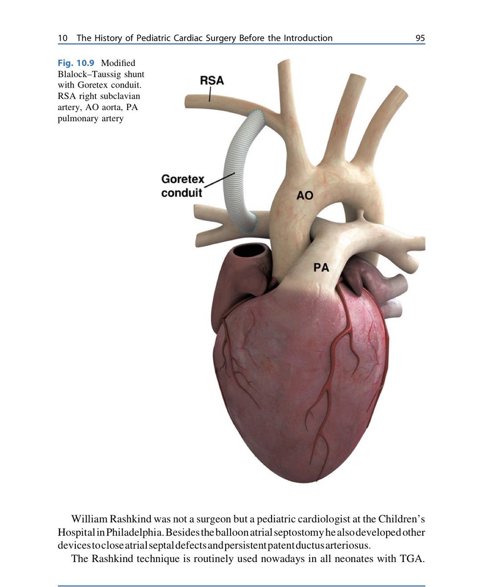 alex1708ander's tweet photo. First learn the procedure. Then image it. ⭐ Understanding 🧠 drives imaging 🖥️ #learnfirst #echofirst https://t.co/xWvcDjz2dC