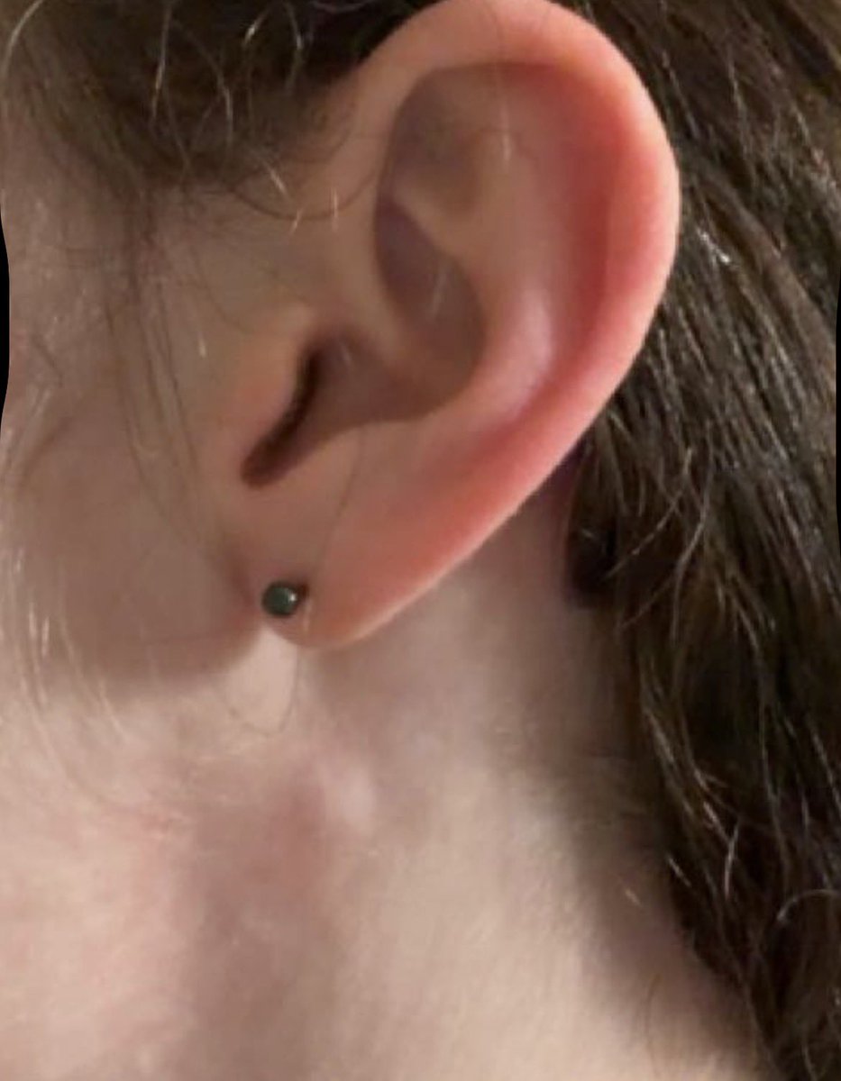 caelusseraphim's tweet photo. lowkey highkey think i got a tumor in my neck. it’s about 1 cm in diameter and it’s hard as a rock and doesn’t move with my skin so i know it’s not a pimple. i personally think it would be very funny if i had cancer but that is sadly unlikely. https://t.co/arAIq68mFQ
