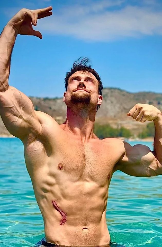 InternetH0F's tweet photo. Fitness influencer Connor Murphy allegedly injected himself with gold in the weeks leading up to his death thinking it would give him "special powers" 

"He started to get this fixation on gold, he started to believe that gold was some gatekept mineral by the higher ups" https://t.co/VUx0hWJJLb