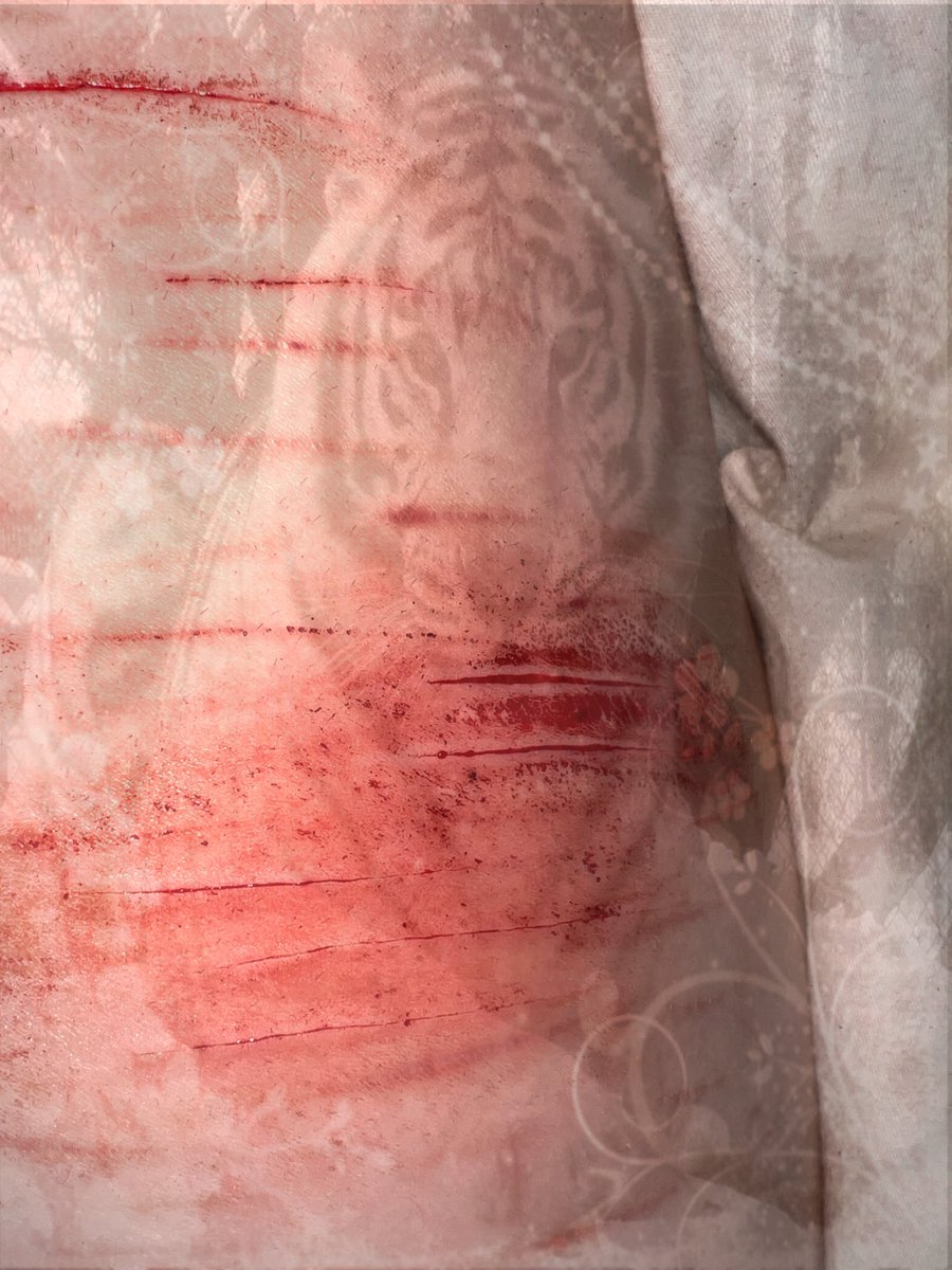 ilovetigerss011's tweet photo. Fake sfx makeup #sh #shtwt #selfharm #larp #catscratch #styro #fake #sfx https://t.co/1Vzn1zS73i