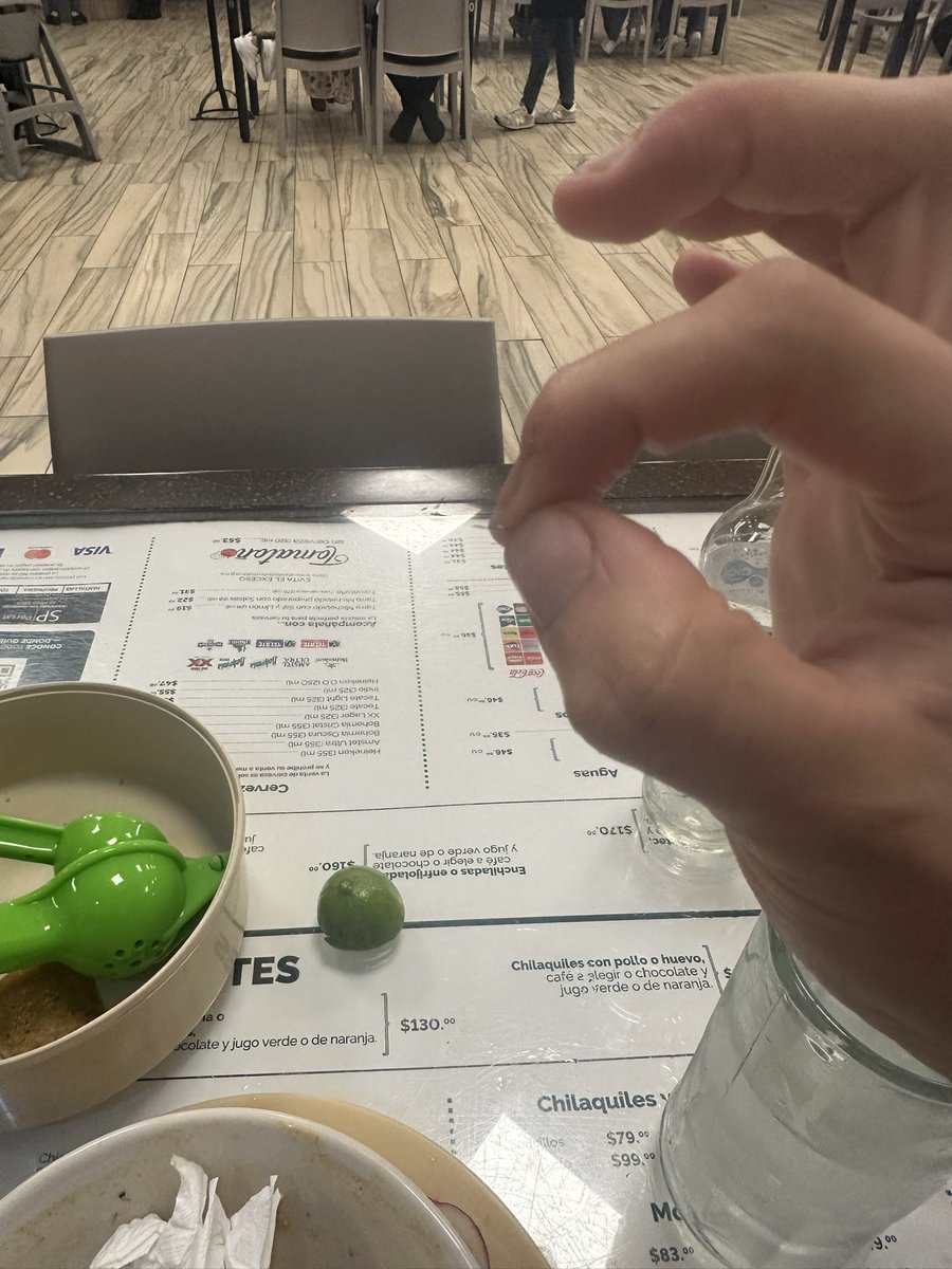 IRC31's tweet photo. @lacasadetono venían alambres en su comida , tendré que ir al doctor @Profeco https://t.co/DNG2mpxiXR