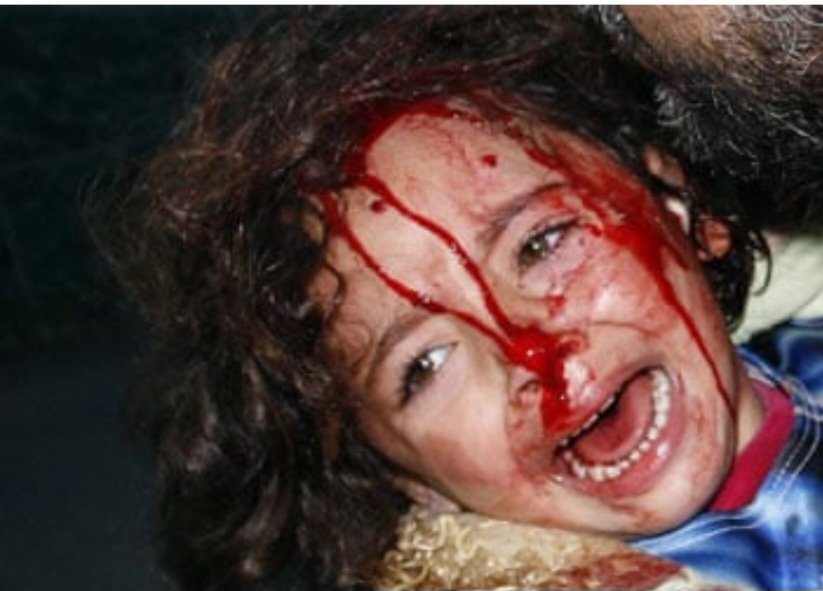 martinking_81's tweet photo. @DreyfusJames Face of one of thousands of Palestinian kids, babies that this woman fought so hard to keep killing them. 
Good luck to you if that is an example to you. Damaged individual if so. You must have known for sure...but put it under the rock cos...hey, life is a bitch eh, dude. https://t.co/5Y3fgalTEz