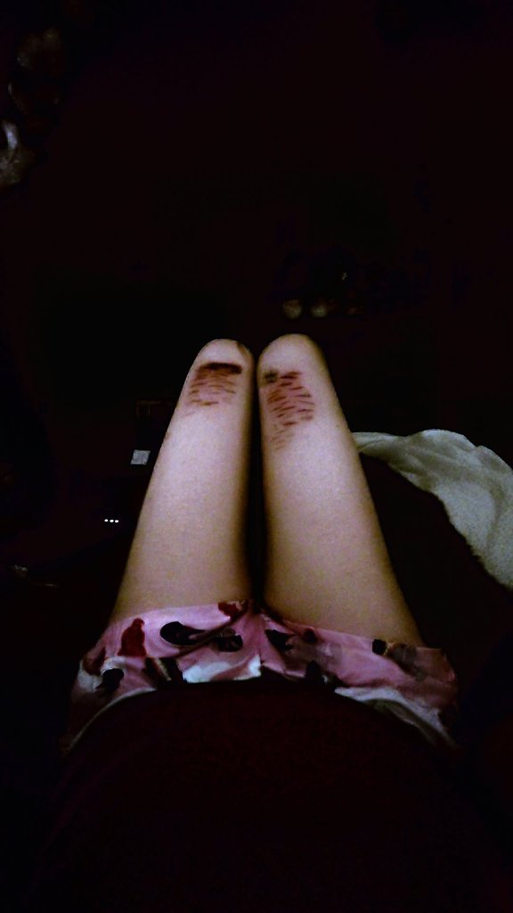 Guttznstuffz's tweet photo. (TW SPECIAL EFFECTS ALL FAKE) These kinda remind me of a horror game!!  #shhtwt https://t.co/NNgr08hMay