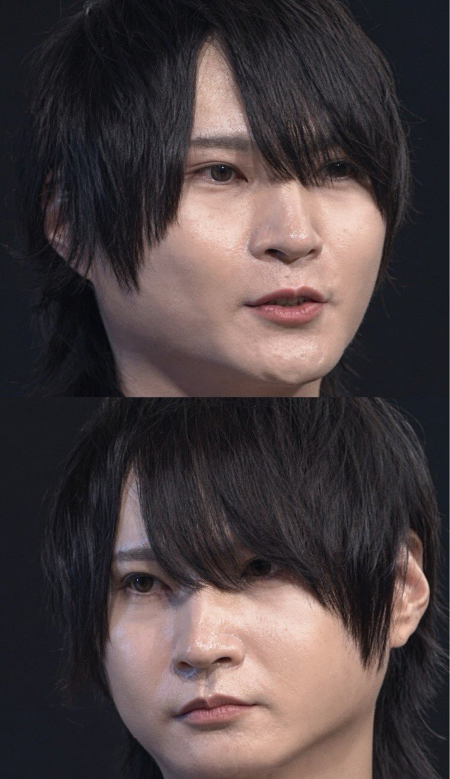 mtgjdpa's tweet photo. ホストコール見て感じたけどピンピンの肌質になりたく無い人は踏んではならない地雷整形があるんよ

・痩せ型インモード
・目の下のクマ取りのナノリッチ
・ジュベルック
・人工真皮の貴族手術
・人中短縮の引き攣れ
・コラーゲン糸リフト
・冷凍脂肪移植
・肌育注射
・ヒアルロン酸
・ボトックス
・連続ハイフ
・目の下PRPのフィブラストスプレー