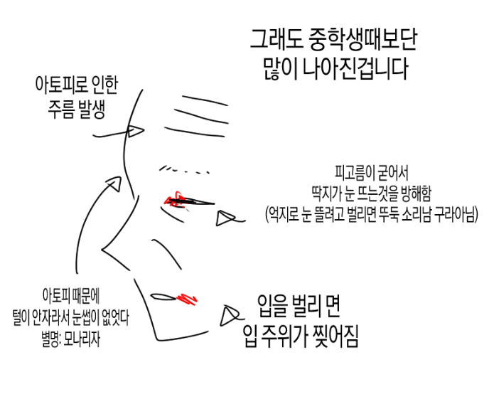 J13K0's tweet photo. 실명이 된 이유 https://t.co/HkD4bnodpS