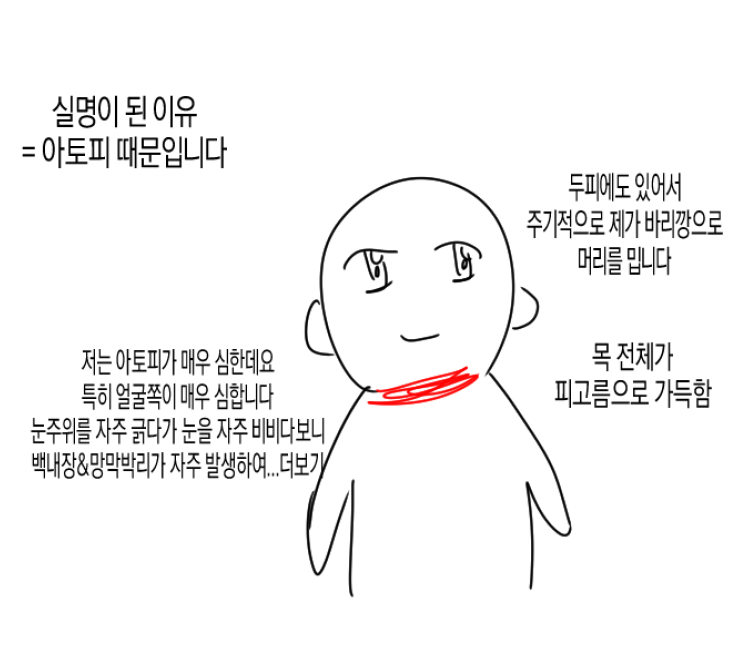 J13K0's tweet photo. 실명이 된 이유 https://t.co/HkD4bnodpS