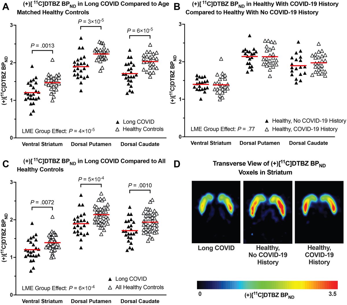 vipintukur's tweet photo. New study provides first evidence of dopamine system injury in the brain of #LongCOVID patients

➡️ The new data suggest that COVID-19 may leave a biochemical footprint in one of the brain’s most critical signaling systems.

➡️ Researchers found evidence of injury to dopamine-producing neurons after SARS-CoV-2 infection—a pathway essential for movement, motivation, reward, and cognition. 

➡️ The findings may help explain persistent symptoms such as brain fog, fatigue, impaired concentration, and mood disturbances seen in some patients after COVID-19.  1/